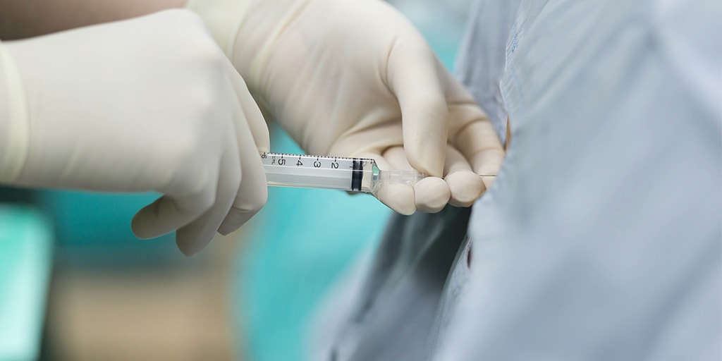 Bloqueo analgesico