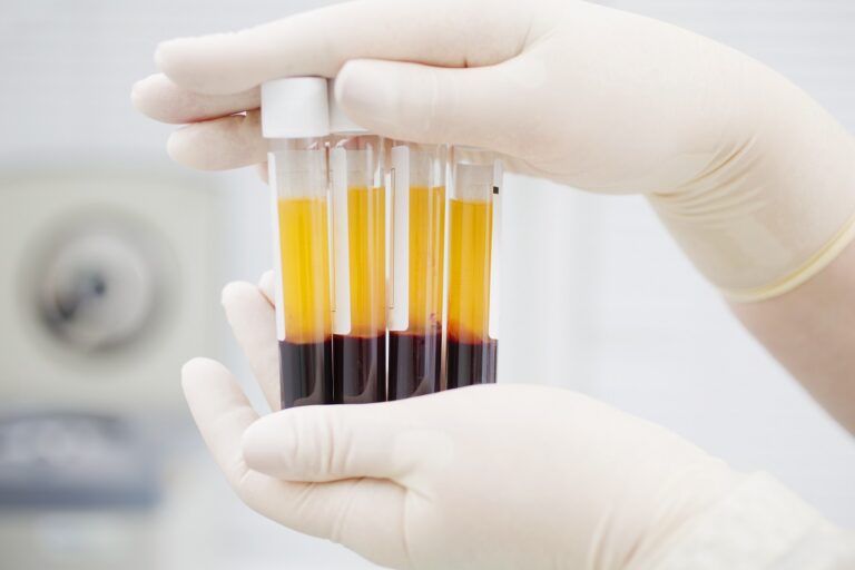 prp medicina regenerativa