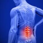 Espondiloartrosis: Qué es, síntomas y opciones de tratamiento para el dolor